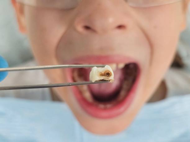 Best Emergency Cosmetic Dentistry in Chickasaw, AL